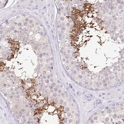 FLJ10808 Antibody, Novus Biologicals:Antibodies:Primary Antibodies