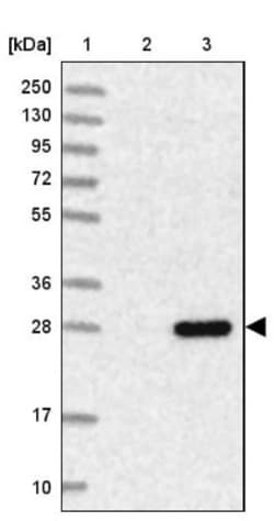 FLJ11184 Antibody, Novus Biologicals 0.1mL; Unlabeled:Antibodies, Polyclonal
