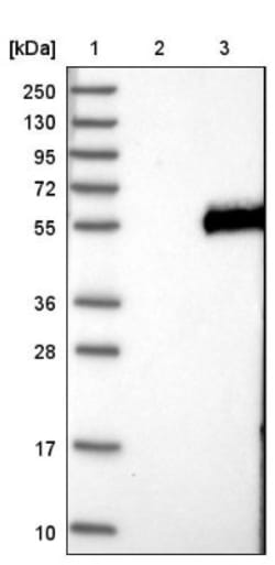 POMK/SGK196 Antibody, Novus Biologicals 0.1mL; Unlabeled:Antibodies, Polyclonal