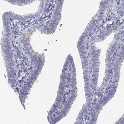 FLJ23834 Antibody, Novus Biologicals:Antibodies:Primary Antibodies