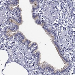 FLJ23834 Antibody, Novus Biologicals:Antibodies:Primary Antibodies