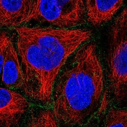 FLVCR Antibody, Novus Biologicals 0.1mL; Unlabeled:Antibodies, Polyclonal