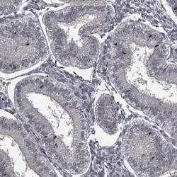 FLVCR2 Antibody, Novus Biologicals 0.1mL; Unlabeled:Antibodies, Polyclonal