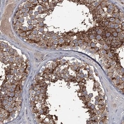 FLVCR2 Antibody, Novus Biologicals 0.1mL; Unlabeled:Antibodies, Polyclonal