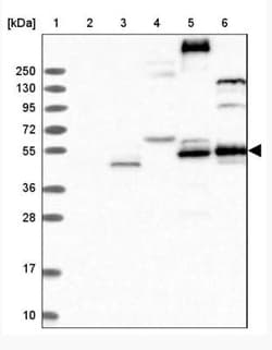 FLVCR2 Antibody, Novus Biologicals 0.1mL; Unlabeled:Antibodies, Polyclonal