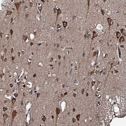 FLYWCH1 Antibody, Novus Biologicals 0.1mL; Unlabeled:Antibodies, Polyclonal