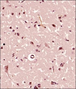 FMN2 Antibody, Novus Biologicals:Antibodies:Primary Antibodies