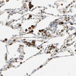FMNL1 Antibody, Novus Biologicals 0.1mL; Unlabeled:Antibodies, Polyclonal