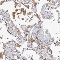 FMNL1 Antibody, Novus Biologicals 0.1mL; Unlabeled:Antibodies, Polyclonal