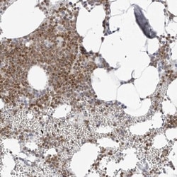 FMNL1 Antibody, Novus Biologicals 0.1mL; Unlabeled:Antibodies, Polyclonal