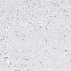 FMNL1 Antibody, Novus Biologicals 0.1mL; Unlabeled:Antibodies, Polyclonal