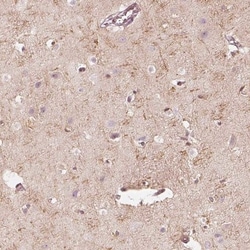 FMNL2 Antibody, Novus Biologicals:Antibodies:Primary Antibodies