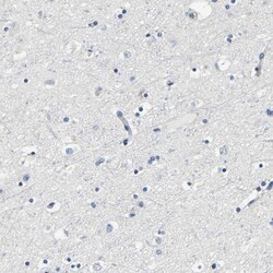 FMO5 Antibody, Novus Biologicals 0.1mL; Unlabeled:Antibodies, Polyclonal