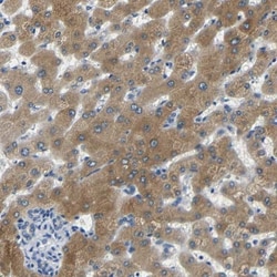 FMO5 Antibody, Novus Biologicals 0.1mL; Unlabeled:Antibodies, Polyclonal