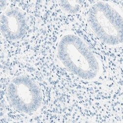 FMR1NB Antibody, Novus Biologicals 25 &mu;L | Buy Online | Novus Biologicals | Fisher Scientific