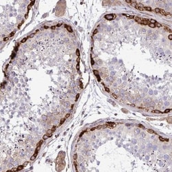 FMRP Antibody, Novus Biologicals:Antibodies:Primary Antibodies