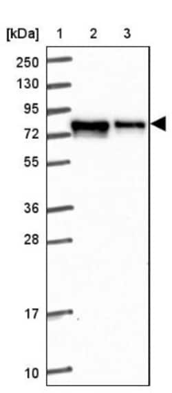 FMRP Antibody, Novus Biologicals:Antibodies:Primary Antibodies