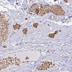 FN3K Antibody, Novus Biologicals 0.1mL; Unlabeled:Antibodies, Polyclonal