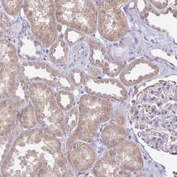 FN3K Antibody, Novus Biologicals 0.1mL; Unlabeled:Antibodies, Polyclonal