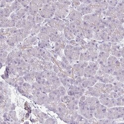 FN3K Antibody, Novus Biologicals 0.1mL; Unlabeled:Antibodies, Polyclonal