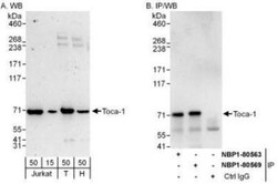 FNBP1L Antibody, Novus Biologicals 100 &mu;L | Buy Online | Novus Biologicals | Fisher Scientific