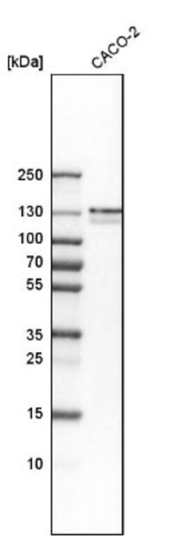 FNBP3 Antibody, Novus Biologicals 0.1mL; Unlabeled:Antibodies, Polyclonal