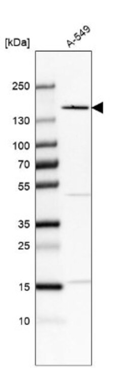 FNDC3B Antibody, Novus Biologicals 25 &mu;L | Buy Online | Novus Biologicals | Fisher Scientific