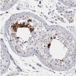 FNDC8 Antibody, Novus Biologicals 0.1mL; Unlabeled:Antibodies, Polyclonal