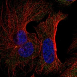 FNTB Antibody, Novus Biologicals 25 &mu;L, Unlabeled:Antibodies, Polyclonal