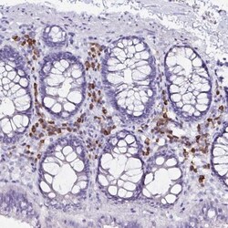 FNTB Antibody, Novus Biologicals 25 &mu;L, Unlabeled:Antibodies, Polyclonal