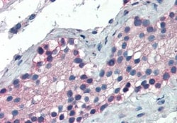 FOXE1 Antibody, Novus Biologicals 0.1mg; Unlabeled:Antibodies, Polyclonal