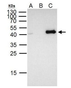 FOXE1 Antibody, Novus Biologicals 100 &mu;L | Buy Online | Novus Biologicals | Fisher Scientific