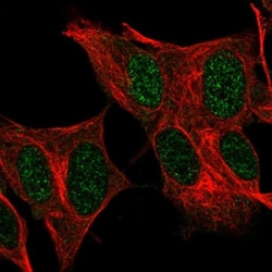FOXR2 Antibody, Novus Biologicals:Antibodies:Primary Antibodies