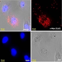 Abnova™ mutaFISH™ c-Mycwt RNA Probes