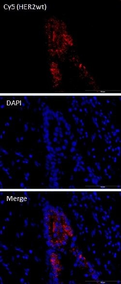 Abnova™ mutaFISH™ HER2wt RNA Probes