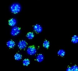 Abnova™ mutaFISH™ EGFRwt RNA Probes