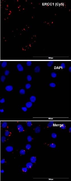 Abnova™ mutaFISH™ ERCC1wt RNA Probes