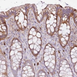 FPR1 Antibody, Novus Biologicals 25 &mu;L; Unlabeled:Antibodies, Polyclonal
