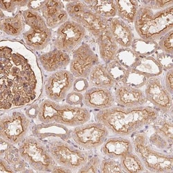 FRAS1 (Fraser syndrome 1) Antibody, Novus Biologicals 0.1mL; Unlabeled:Antibodies,