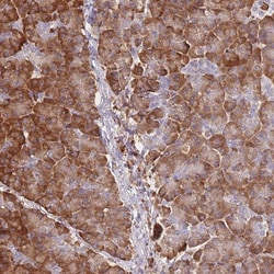 FRAT2 Antibody, Novus Biologicals 0.1mL; Unlabeled:Antibodies, Polyclonal