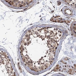 FSIP1 Antibody, Novus Biologicals 25 &mu;L | Buy Online | Novus Biologicals | Fisher Scientific