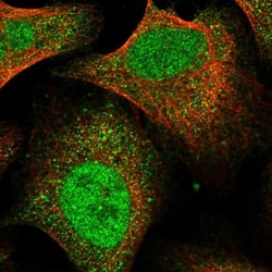 FTSJD2 Antibody, Novus Biologicals 25 &mu;L; Unlabeled:Antibodies, Polyclonal