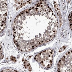 FTSJD2 Antibody, Novus Biologicals 25 &mu;L; Unlabeled:Antibodies, Polyclonal