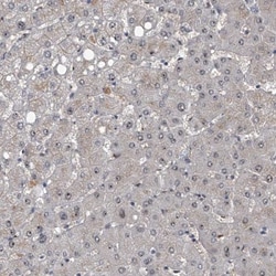 FTSJD2 Antibody, Novus Biologicals 25 &mu;L | Buy Online | Novus Biologicals | Fisher Scientific