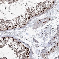 FTSJD2 Antibody, Novus Biologicals 25 &mu;L | Buy Online | Novus Biologicals | Fisher Scientific