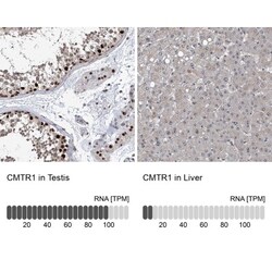 FTSJD2 Antibody, Novus Biologicals 25 &mu;L | Buy Online | Novus Biologicals | Fisher Scientific