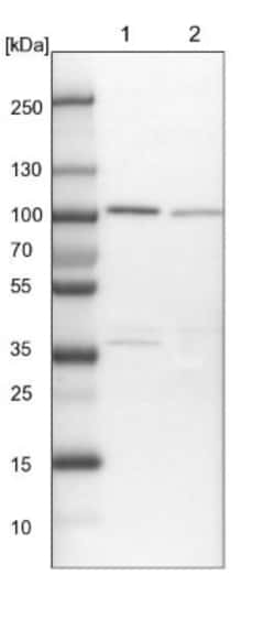 FTSJD2 Antibody, Novus Biologicals 25 &mu;L | Buy Online | Novus Biologicals | Fisher Scientific