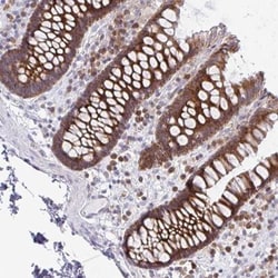 FUBI/MNSF beta/FAU Antibody, Novus Biologicals 0.1mL; Unlabeled:Antibodies,