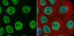 FUBP1 Antibody, Novus Biologicals 0.1mL; Unlabeled:Antibodies, Polyclonal