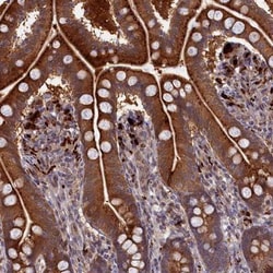 FUK Antibody, Novus Biologicals 0.1mL; Unlabeled:Anticorps, Polyclonal